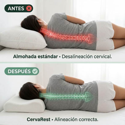 CervaRest™ — La Almohada Estructural